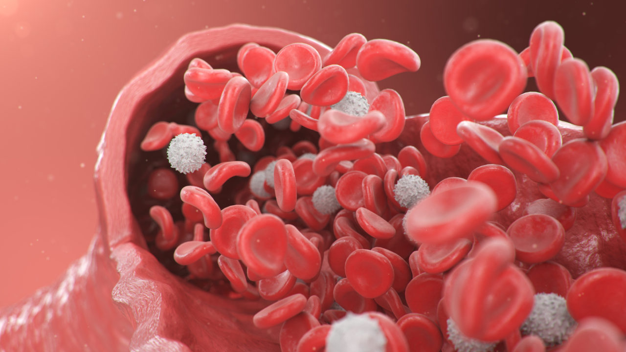 Gigantocellular arteritis - Aging Project