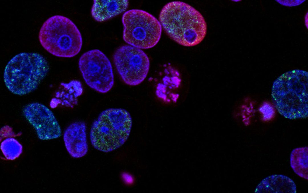Senescenza cellulare, quando le nostre cellule vanno in pensione