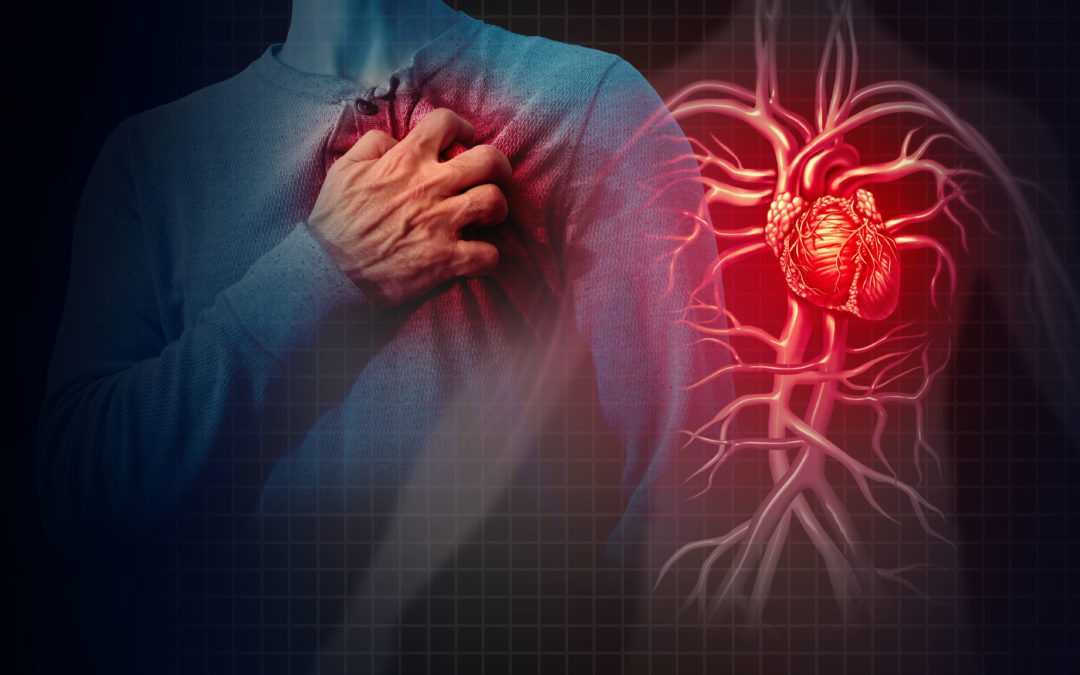 Acute coronary syndrome: reduction of Emergency Department presentations during the COVID-19 period