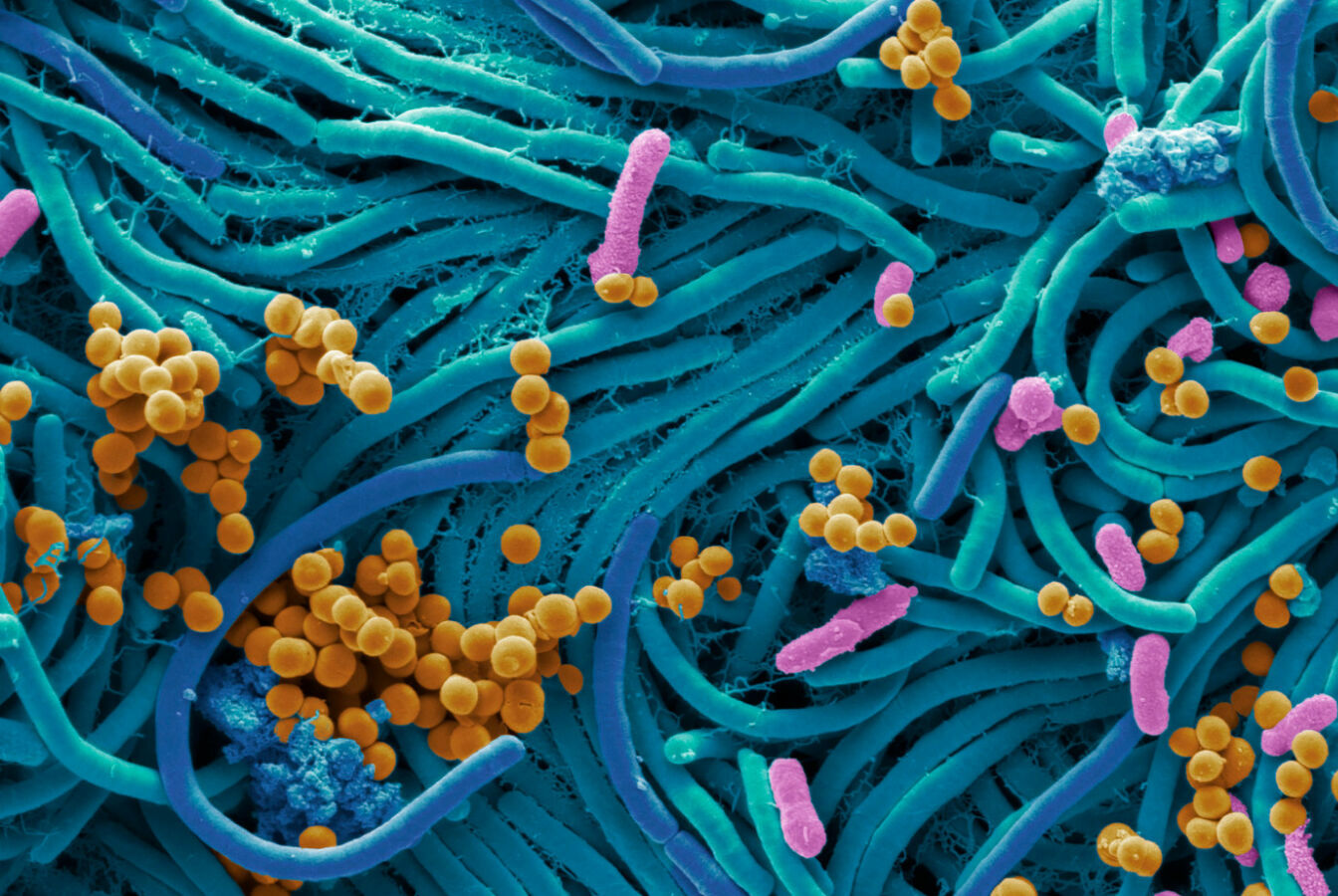 physical activity and microbiota - aging project uniupo