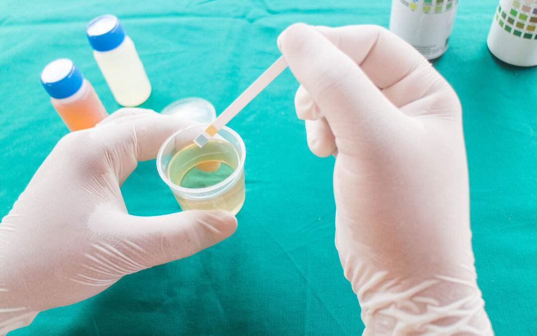 Infezione delle vie urinarie, trattare o non trattare?