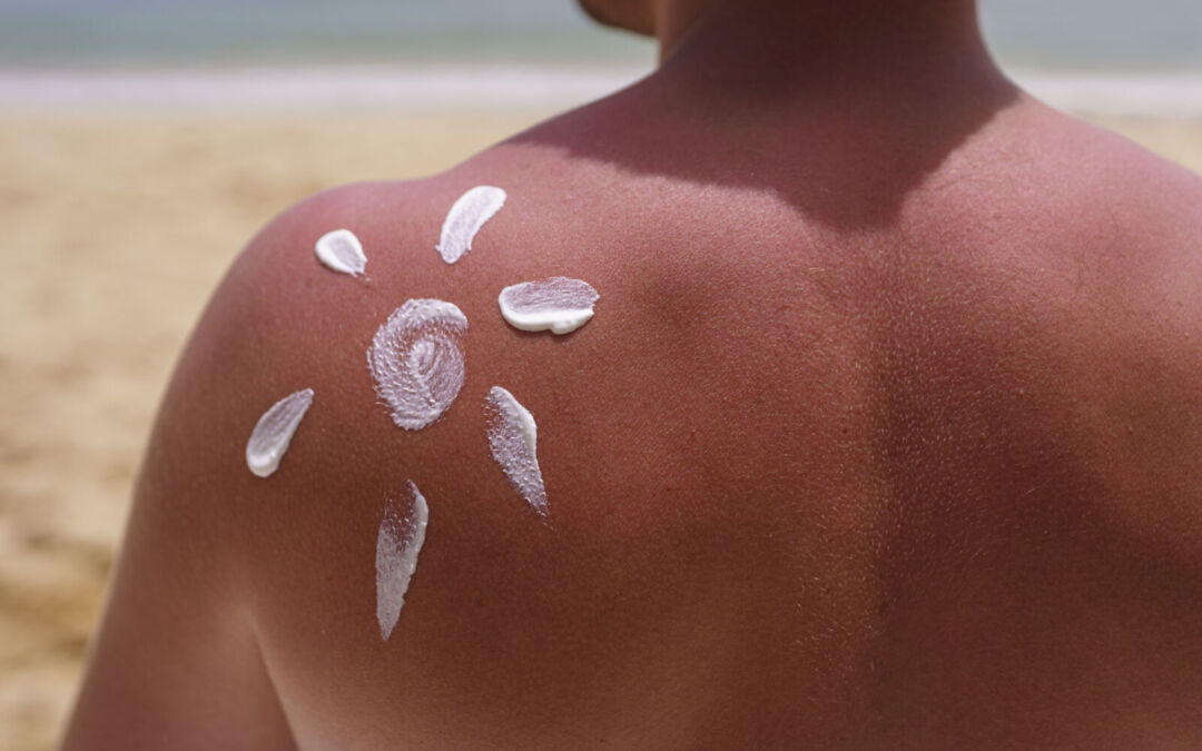 Gli effetti del sole sulla pelle e la fotoprotezione: istruzioni per l’uso