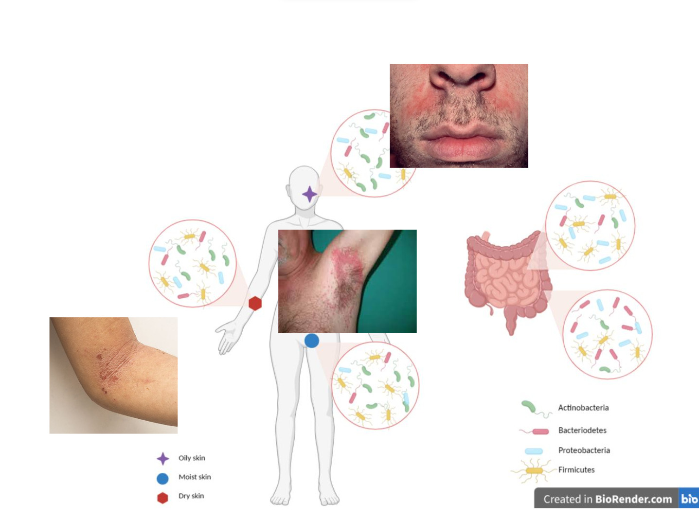 Probiotici in dermatologia 2