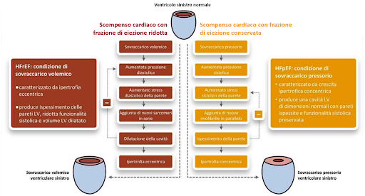 schema scompenso cardiaco