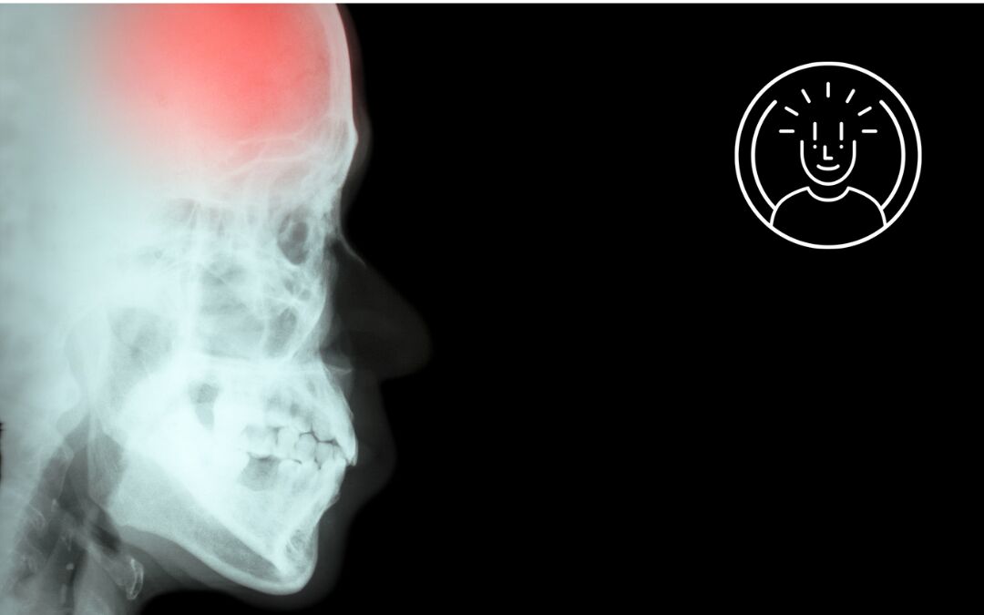 Ischemia, ictus e infarto: parole simili, ma non uguali