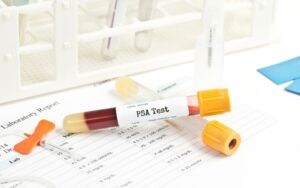 screening tumore della prostata