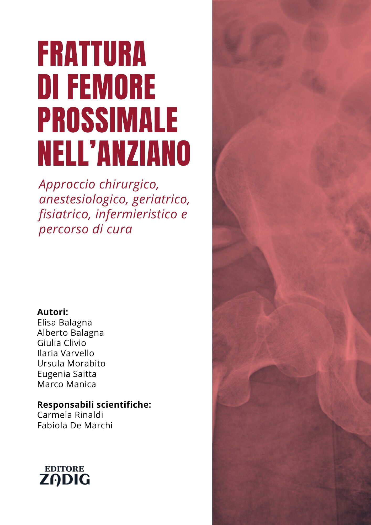 EBOOK FRATTURA FEMORE A4 ebook frattura del femore prossimale nell'anziano
