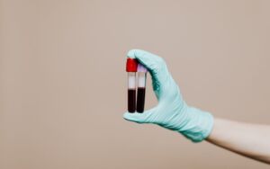 sangue e invecchiamento